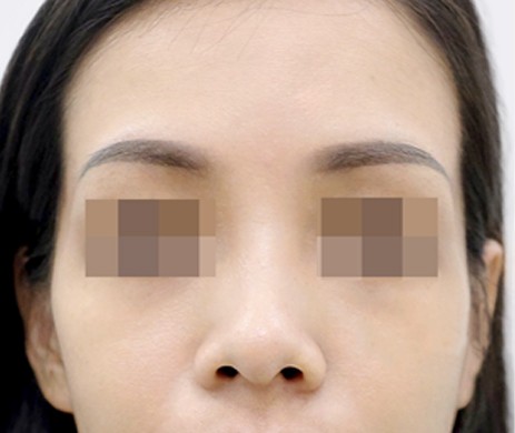 Độn Thái Dương