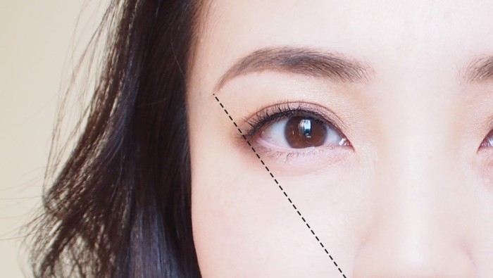 Cắt mắt hai mí Hàn Quốc