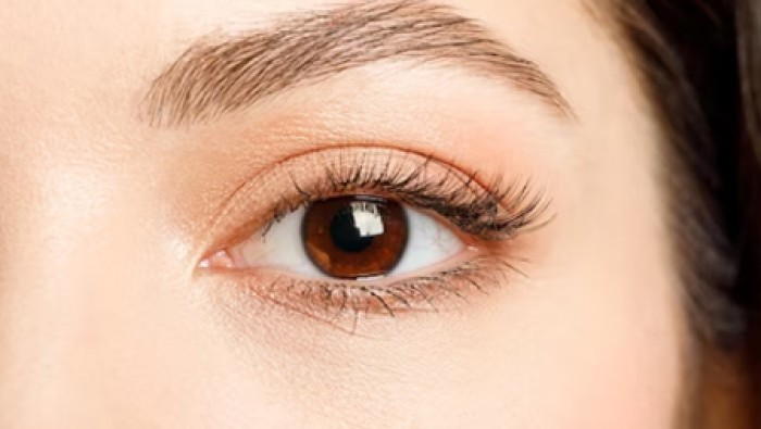 Cắt da – mỡ thừa mí mắt dưới