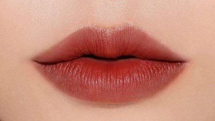 Các phương pháp thẩm mỹ môi tại Charming