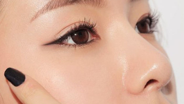 Phương Pháp Nâng Mũi Cấu Trúc