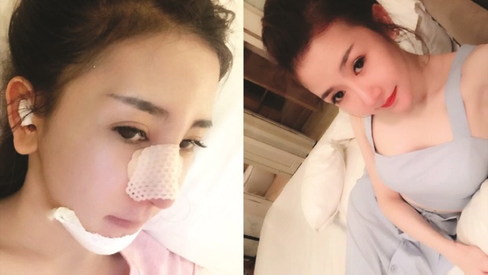 Hot girl phẫu thuật thẩm mỹ gây sốt với triết lý không có phụ nữ xấu