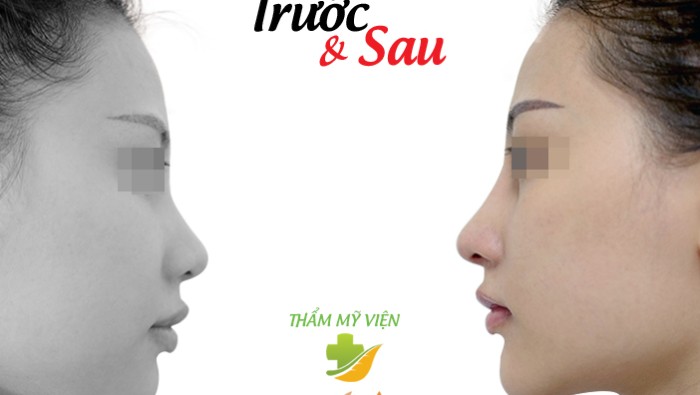 Có nên phẫu thuật thẩm mỹ?