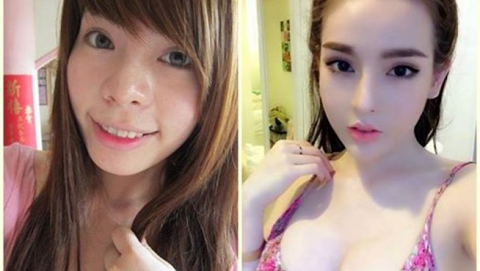 Hot girl Vân Tokyo đẹp ngỡ ngàng sau nâng mũi, độn cằm