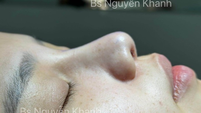 “Đặc sản: dân miền Tây khi ngồi nói chuyện và những chiếc mũi lót sụn tại Charming