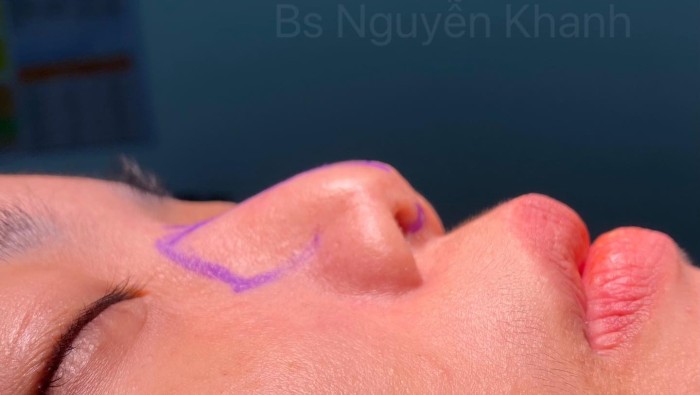 Những lần hữu duyên với khách quen sau nhiều năm sử dụng dịch vụ tại Thẩm mỹ viện Charming