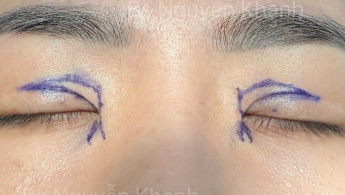 Hành trình mở góc mắt của bạn khách tại TMV Charming