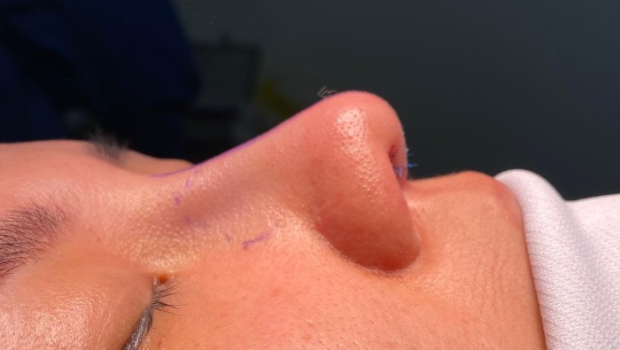 Top những dịch vụ được chọn nhiều nhất vào ngày cuối năm tại phòng khám Bs Nguyễn Khanh