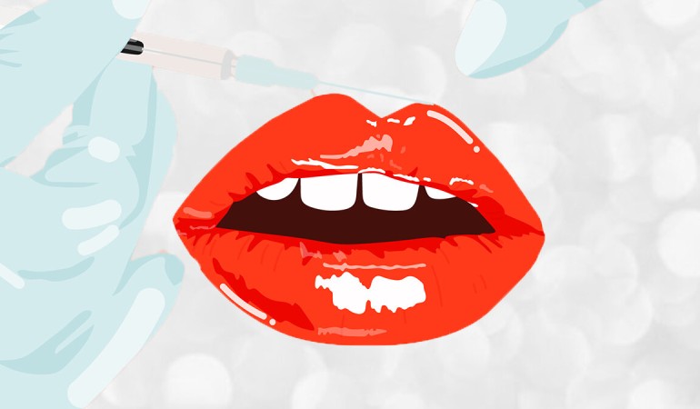 FILLER MÔI CÓ GIỐNG CÁC LOẠI FILLER KHÁC KHÔNG?