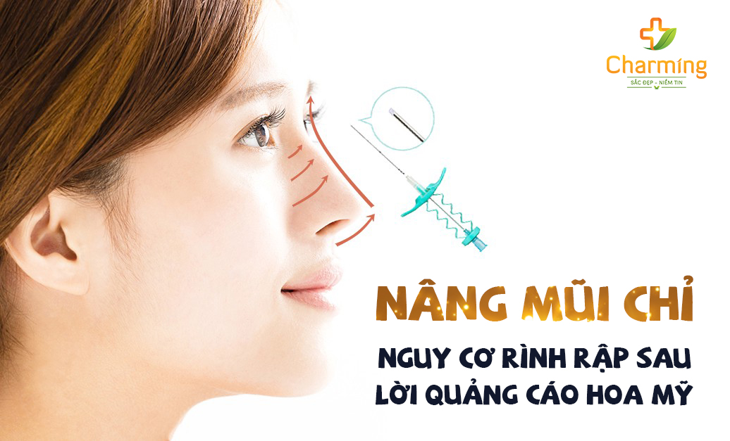 Nâng mũi chỉ