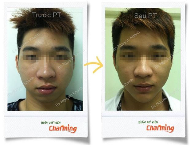 phẫu thuật thẩm mỹ