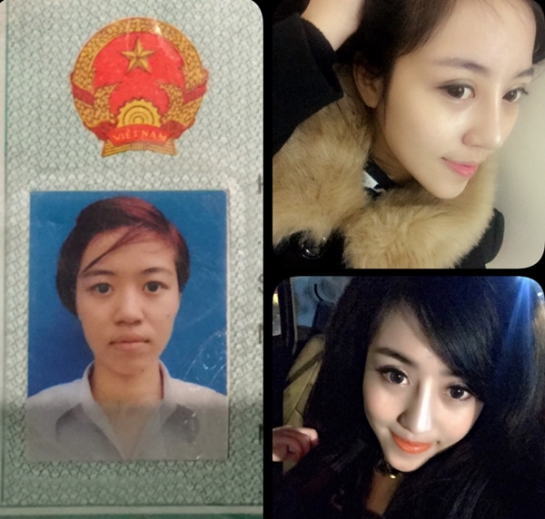 thay đổi sau phẫu thuật