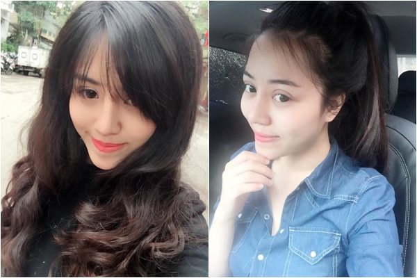 thay đổi sau phẫu thuật