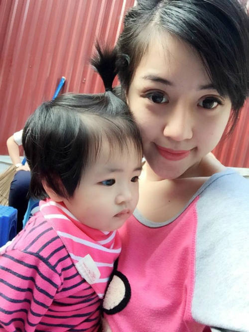 thay đổi sau phẫu thuật