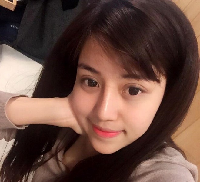 thay đổi sau phẫu thuật