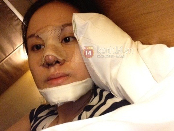 Bà Tưng phẫu thuật thẩm mỹ