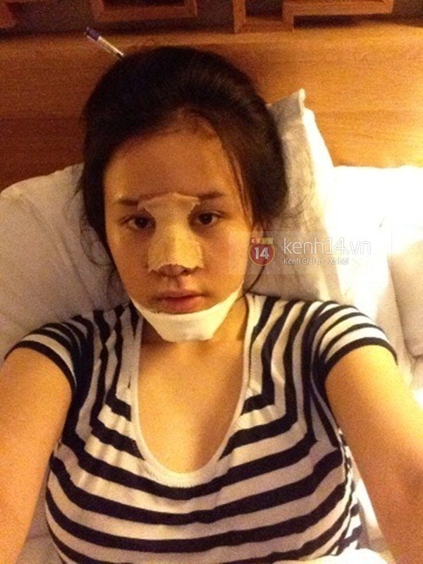 Bà Tưng phẫu thuật thẩm mỹ