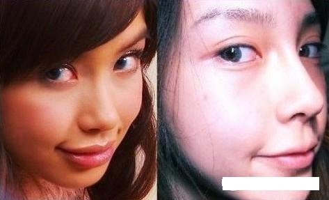 angela baby phau thuat tham my