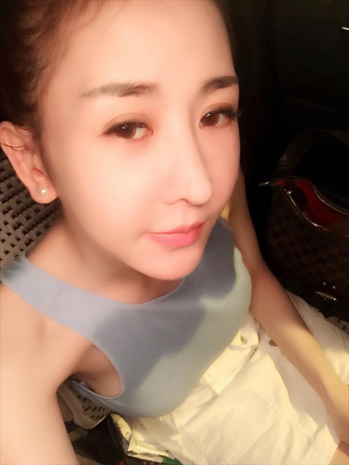 Chu Hằng phẫu thuật thẩm mỹ