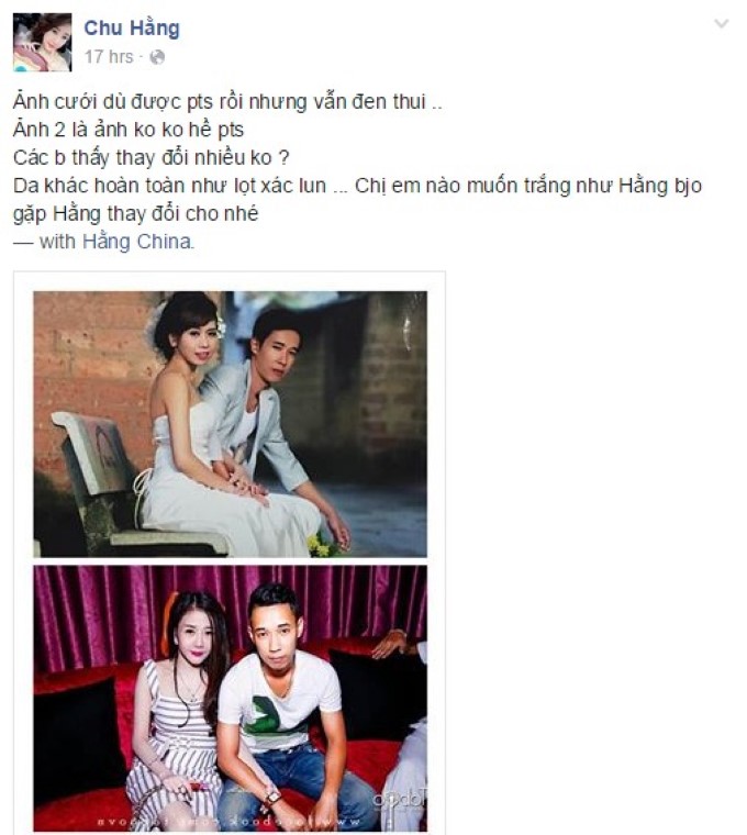 Chu Hằng phẫu thuật thẩm mỹ