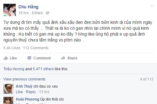 Chu Hằng phẫu thuật thẩm mỹ