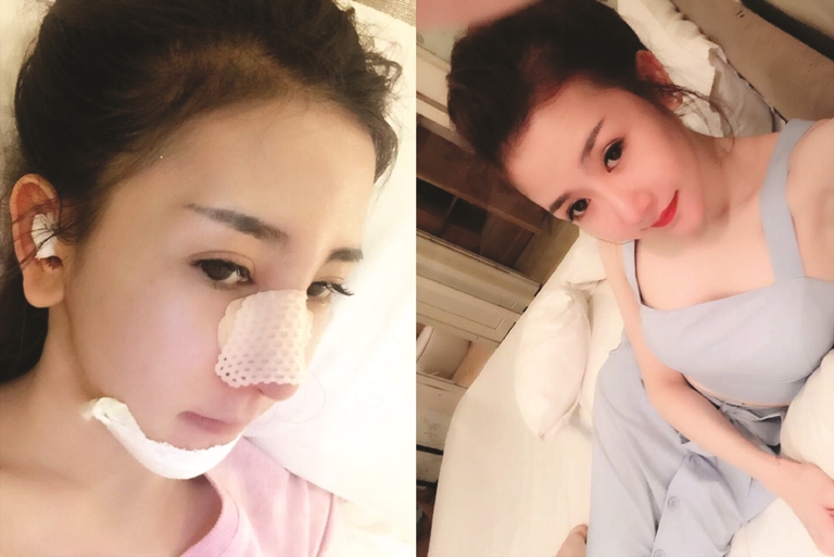 phẫu thuật thẩm mỹ