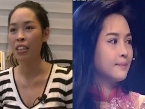 phẫu thuật thẩm mỹ