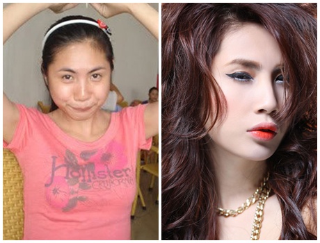 Thủy Tiên trước và sau khi thẩm mỹ