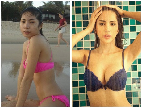 Thủy Tiên trước và sau khi thẩm mỹ