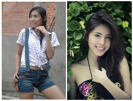 Thủy Tiên trước và sau khi thẩm mỹ