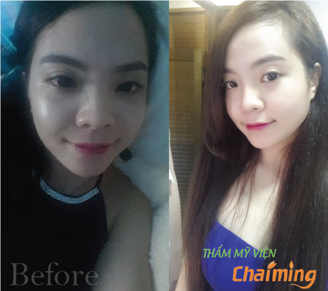 phẫu thuật thẩm mỹ