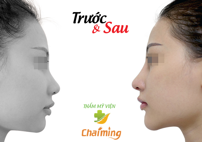 phẫu thuật thẩm mỹ