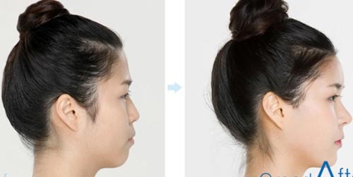 phẫu thuật thẩm mỹ