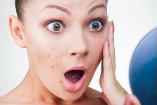 dị ứng mỹ phẩm