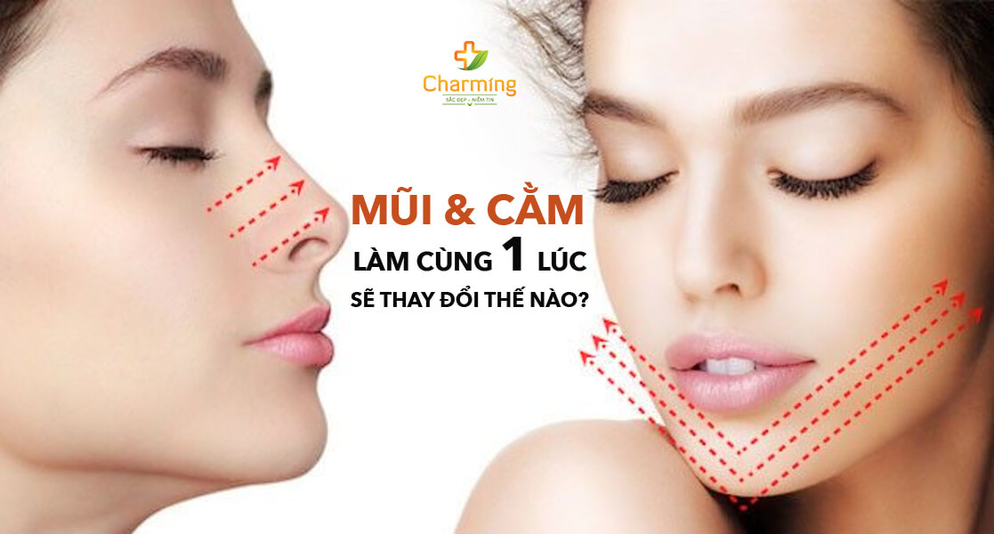 mũi cằm sửa cùng lúc