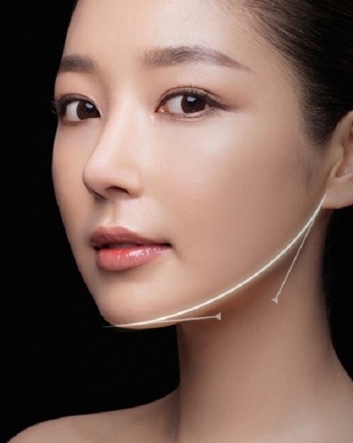 Thời Gian Phục Hồi Và Chăm Sóc Cằm Sau Khi Độn